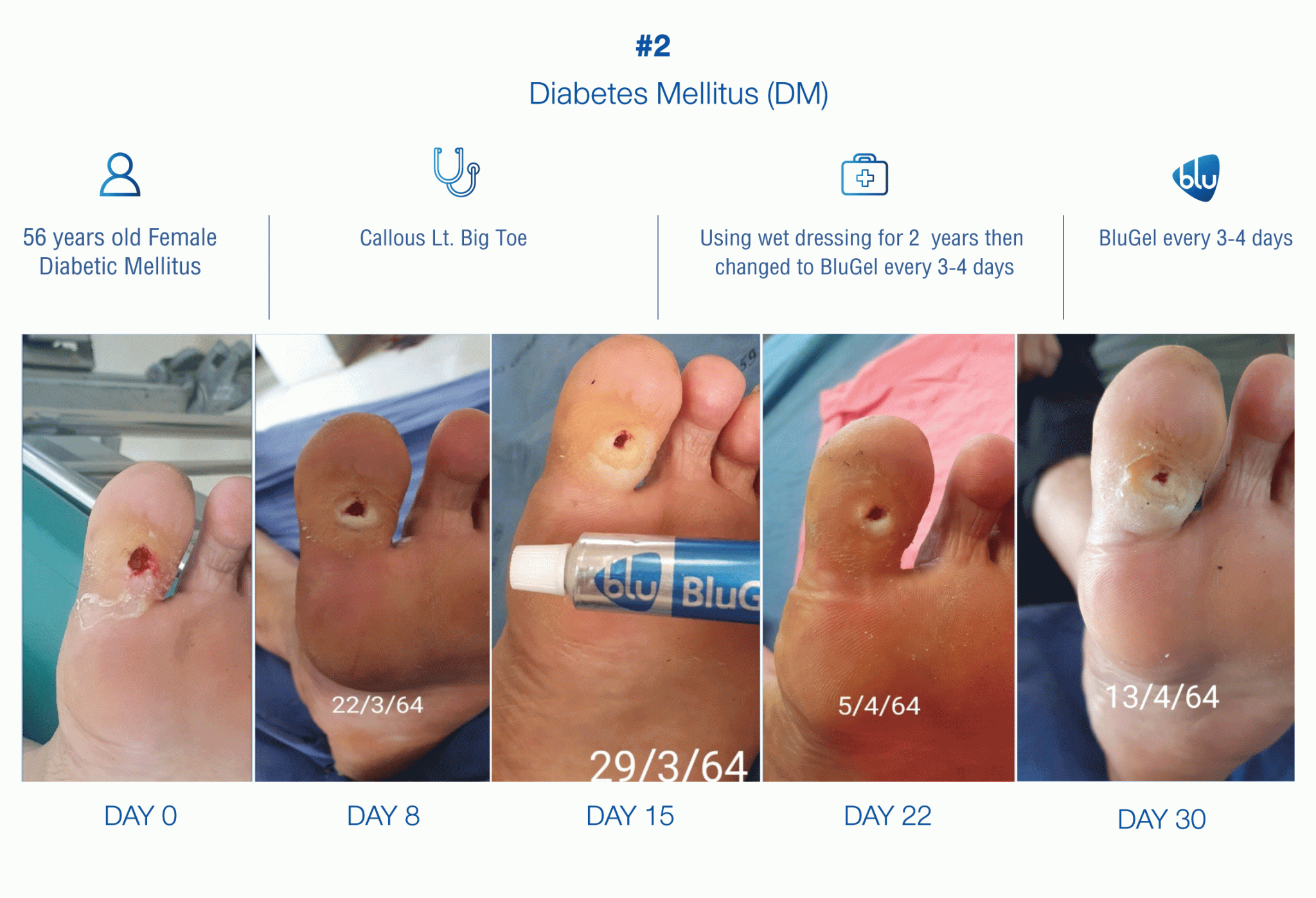Diabetes Mellitus (DM) Novatec Healthcare Co., Ltd.